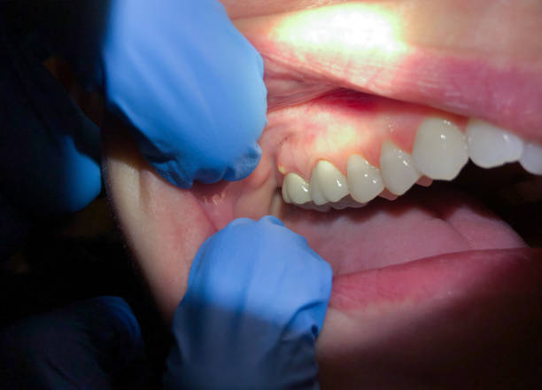 Best Tooth Infection Emergency Dentist  in West Jefferson, OH