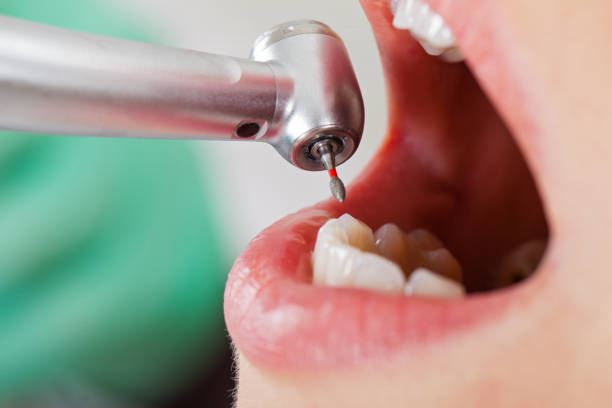 Best Emergency Gum Pain Relief  in West Jefferson, OH
